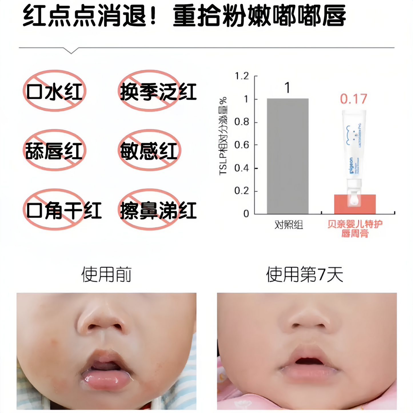 Pigeon Baby Lip Area Protective Balm 12g 贝亲婴儿特护唇周膏