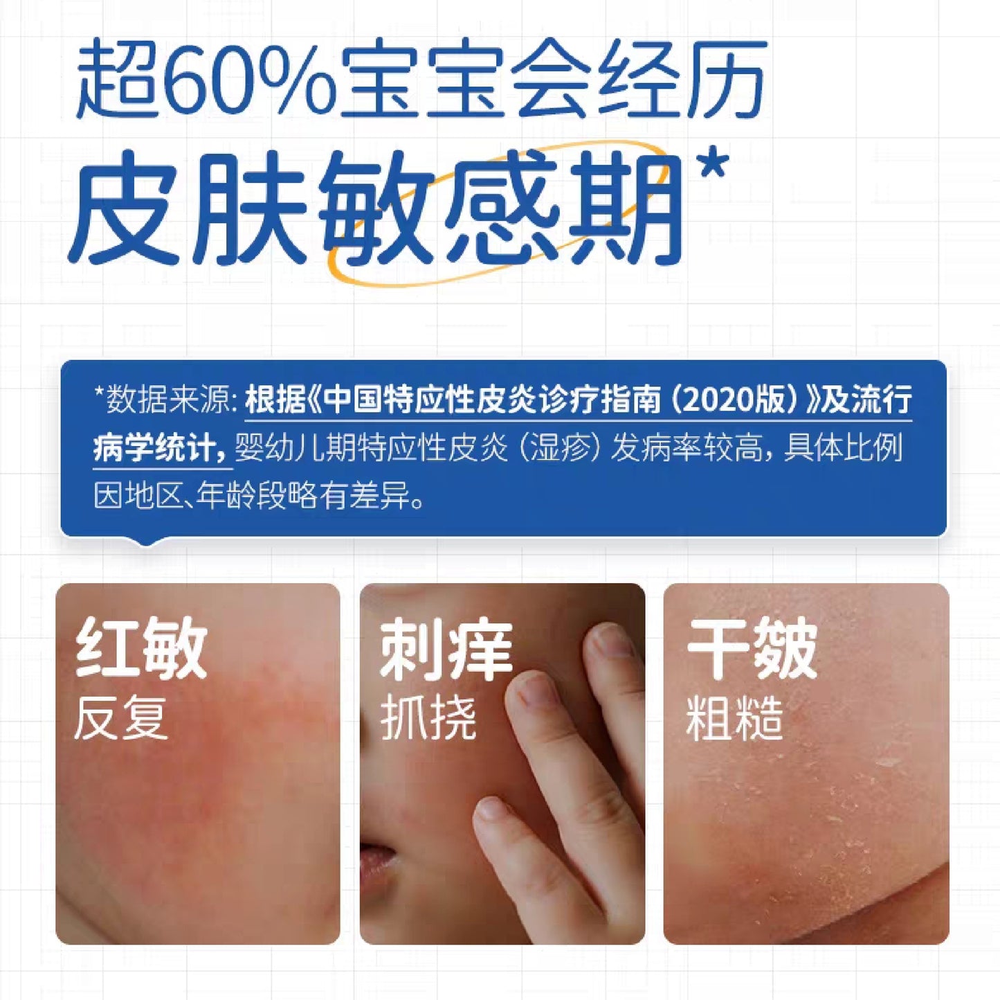 Dexter Baby Calendula Care Cream 50g 戴可思婴儿金盏花护理面霜