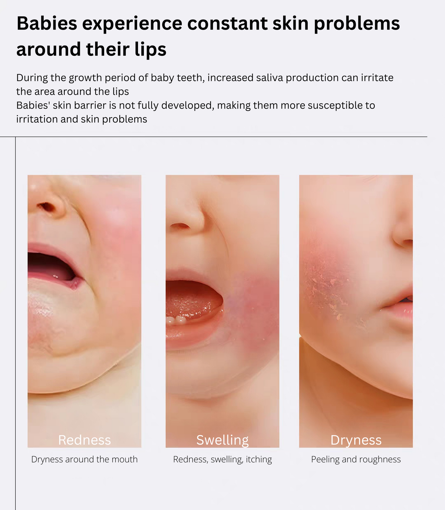 NEWPAGE Baby Lip Area Care Cream 15g 一页婴儿特护唇周霜