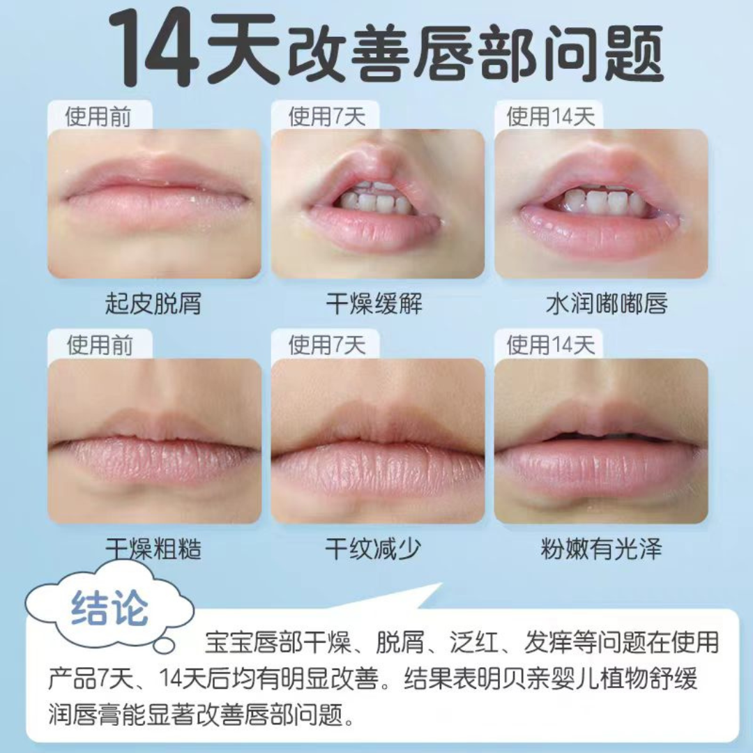 Pigeon Baby Plant Soothing Lip Balm 4g 贝亲婴儿植物舒缓润唇膏