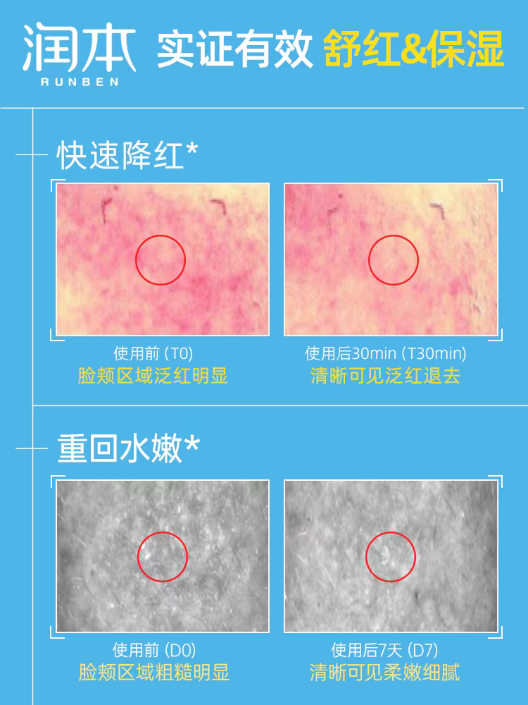 RUNBEN Baby Soothing Mouth Area Cream 15g 润本婴儿舒缓唇周膏