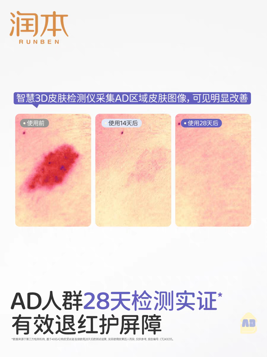 RUNBEN Baby & Toddler Multi-Effect Protective Essence Cream 100g 润本婴幼儿多效安护精华霜