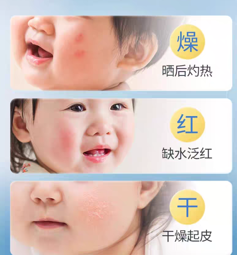 RUNBEN Centella Asiatica Soothing Glacier Spray 99ml 润本积雪草舒缓冰川喷雾