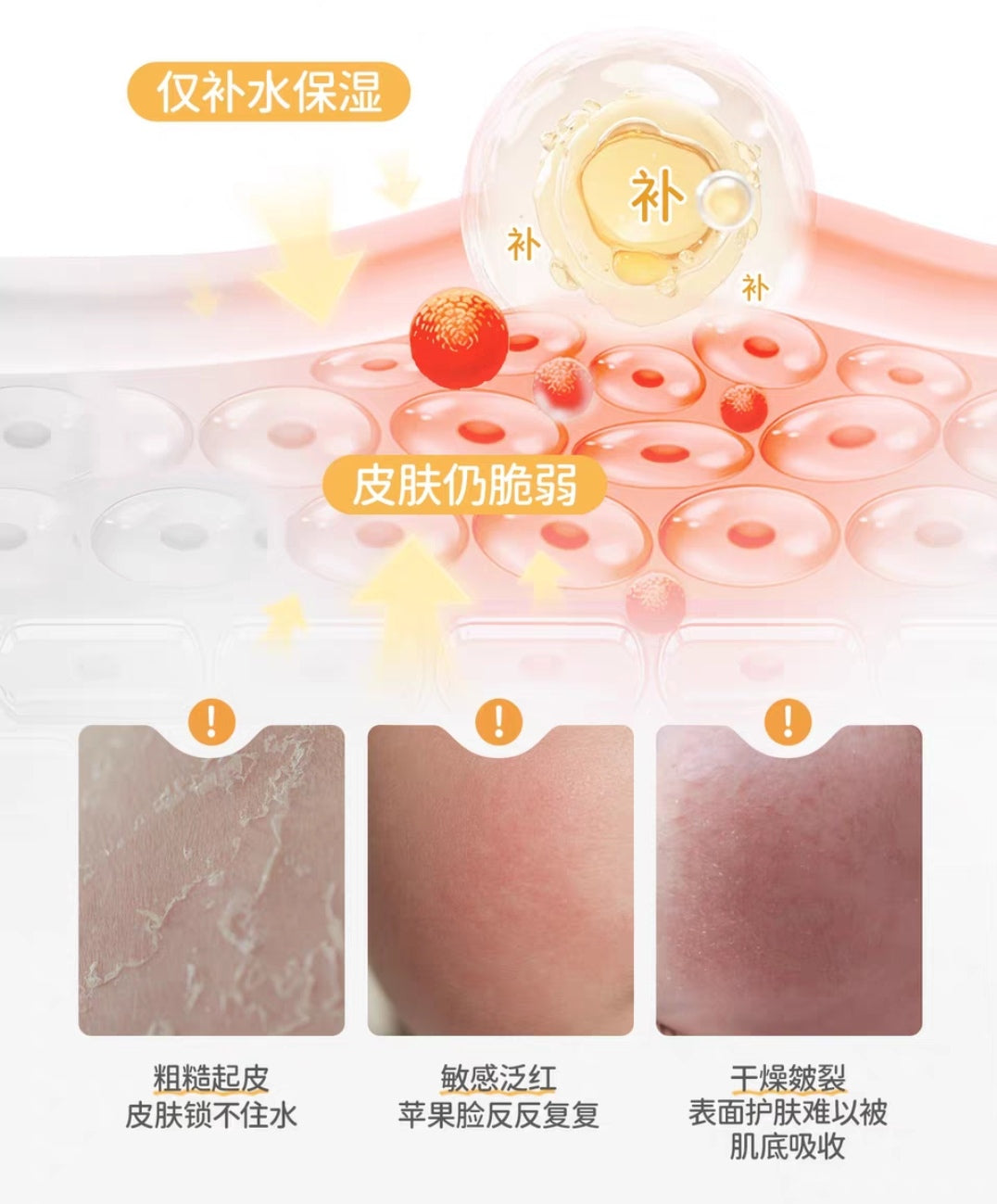 RUNBEN Egg Yolk Oil Special Care Essence Cream 50g 润本蛋黄油特护精华霜