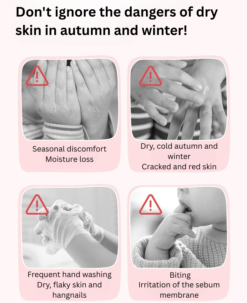 RUNBEN Kids VE Essence Hand Cream 40g 润本儿童维E精华护手霜