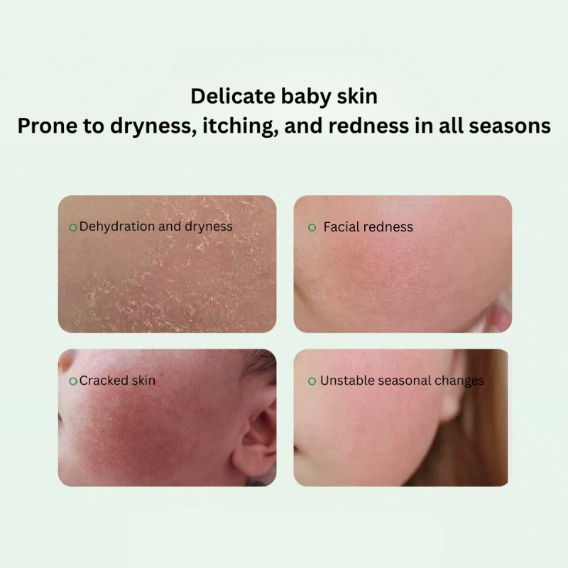 SONGDA Baby Camellia Oil Cream 68g 松达婴儿山茶油面霜