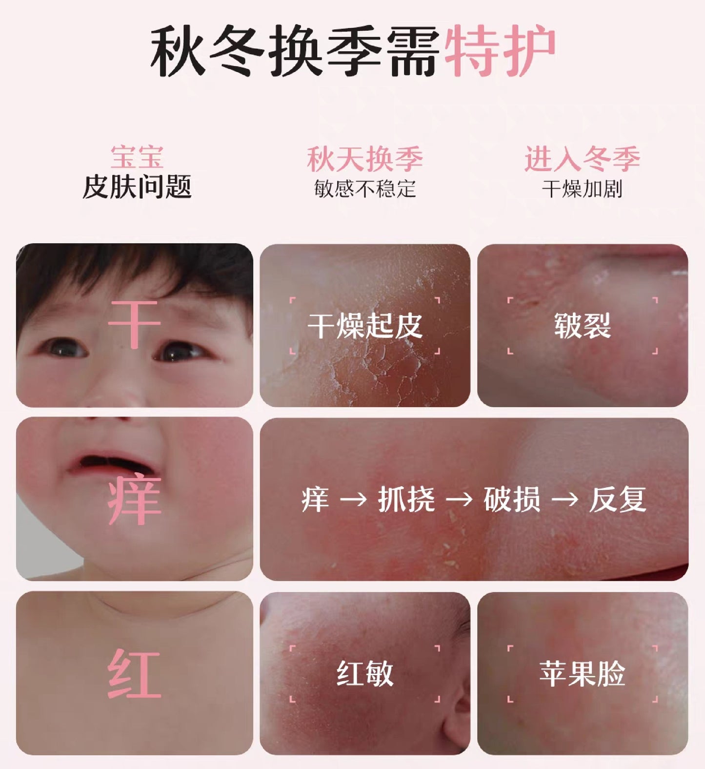 SONGDA Baby Camellia Oil Special Care Cream 98g 松达婴儿山茶油特护霜