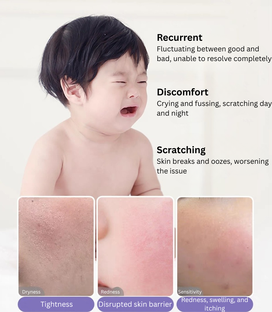 SONGDA Baby Moisturizing Special Care Lotion 118g 松达婴儿水润特护乳