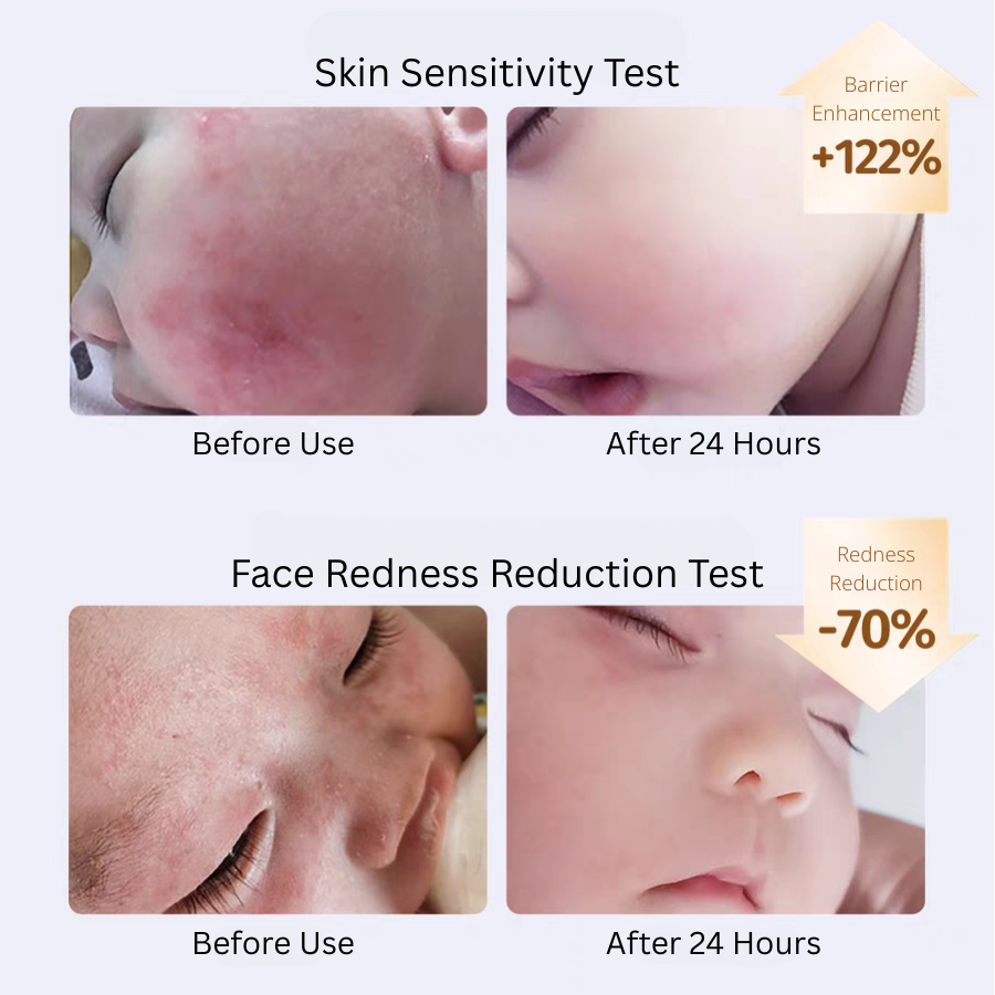 SONGDA Baby Soothing Special Care Cream 48g 松达婴儿舒缓特护霜