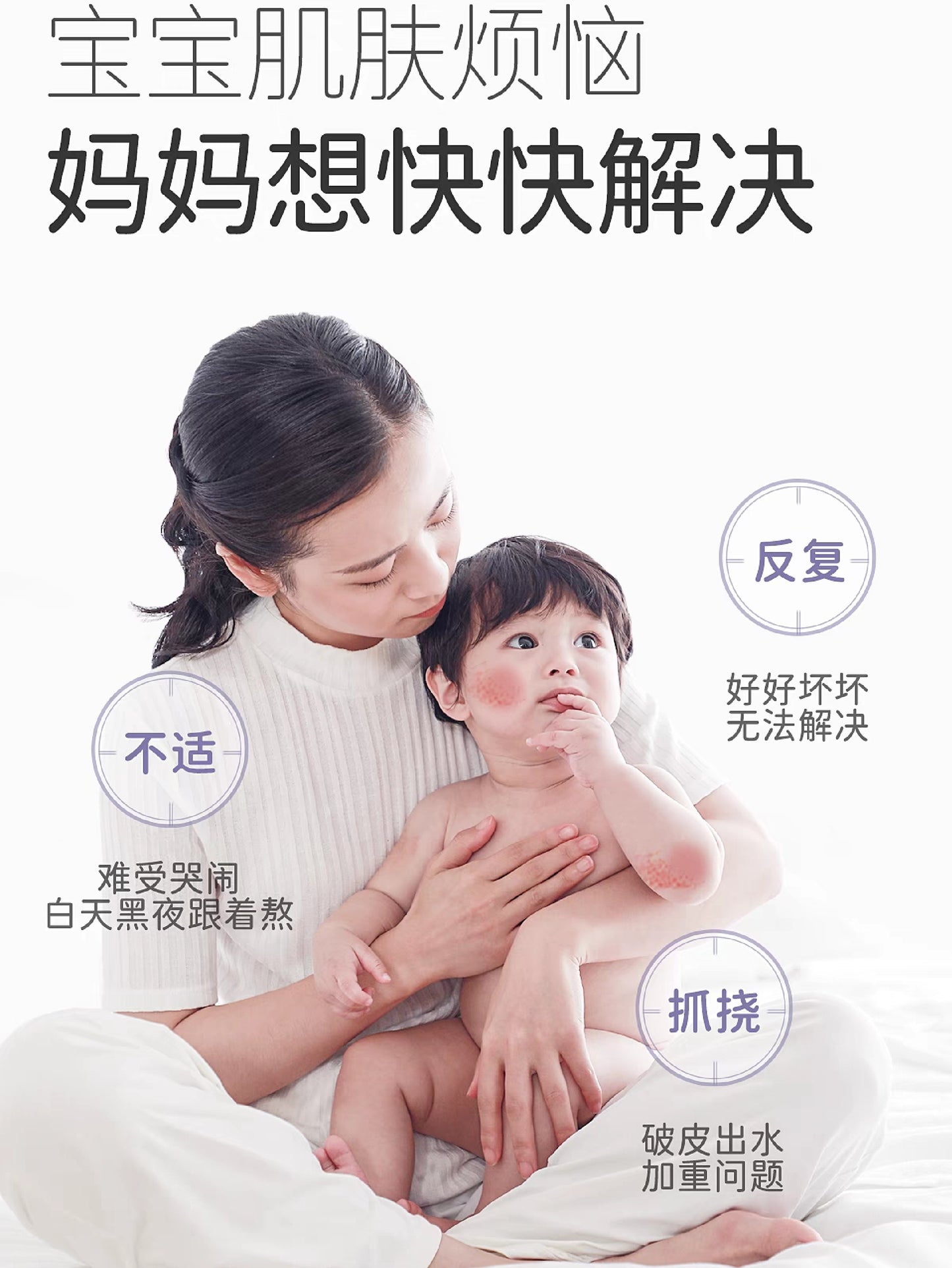 SONGDA Baby Soothing Special Care Cream 48g 松达婴儿舒缓特护霜