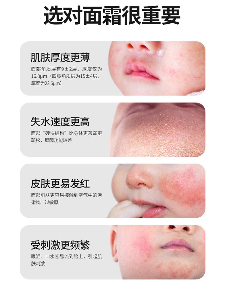 Sunflying Baby Baby Moisturizing And Soothing Face Cream 50g 顺峰宝宝儿童保湿安护面霜