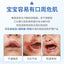 Sunflying Baby Perioral Skin Soothing Isolation Cream 20g 顺峰宝宝口周舒缓隔离霜