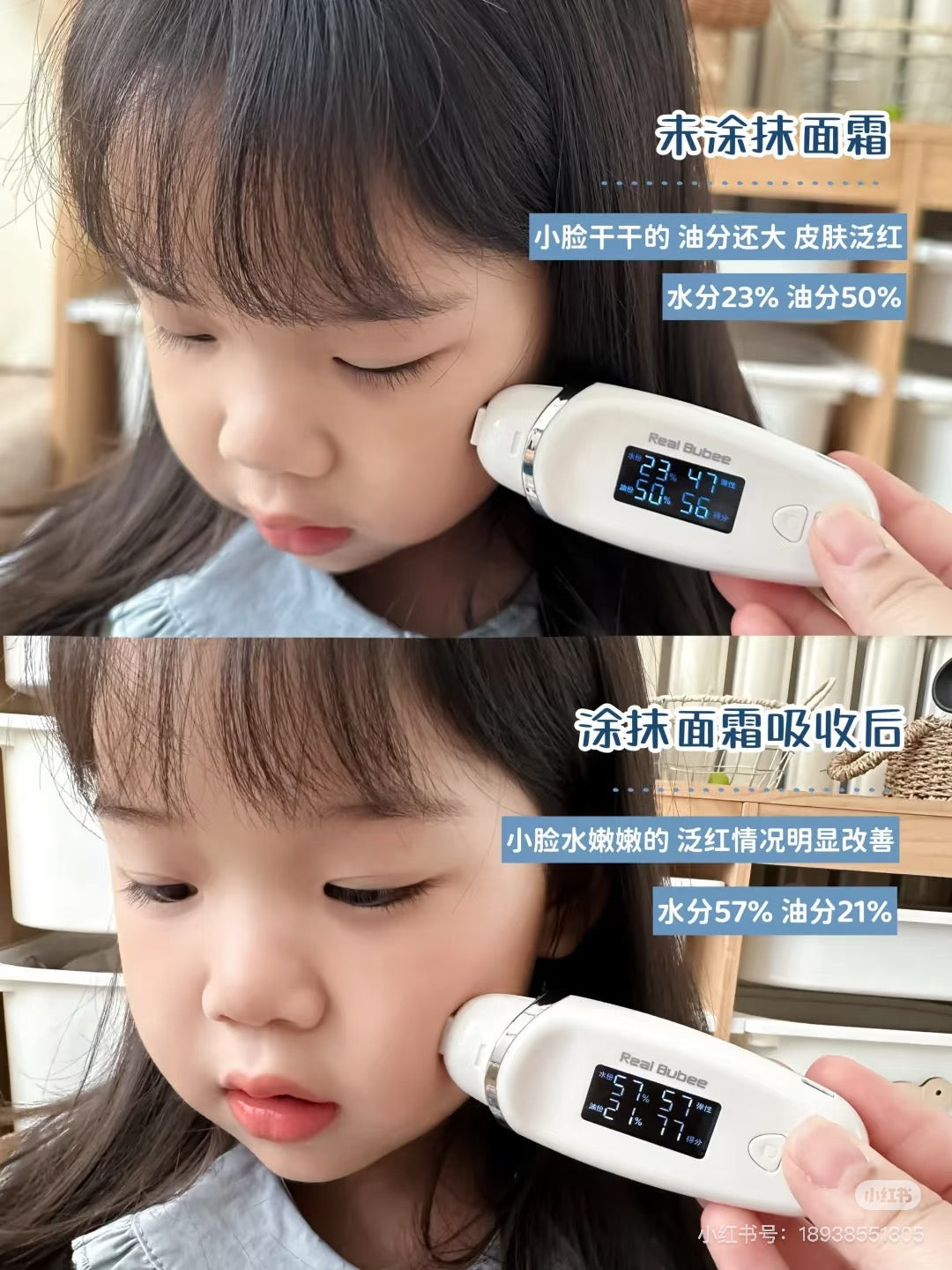 WINONA Baby Multi-Effect Plant-Based Soothing & Moisturizing Cream 50g 薇诺娜宝贝多效植萃舒缓柔润精华面霜