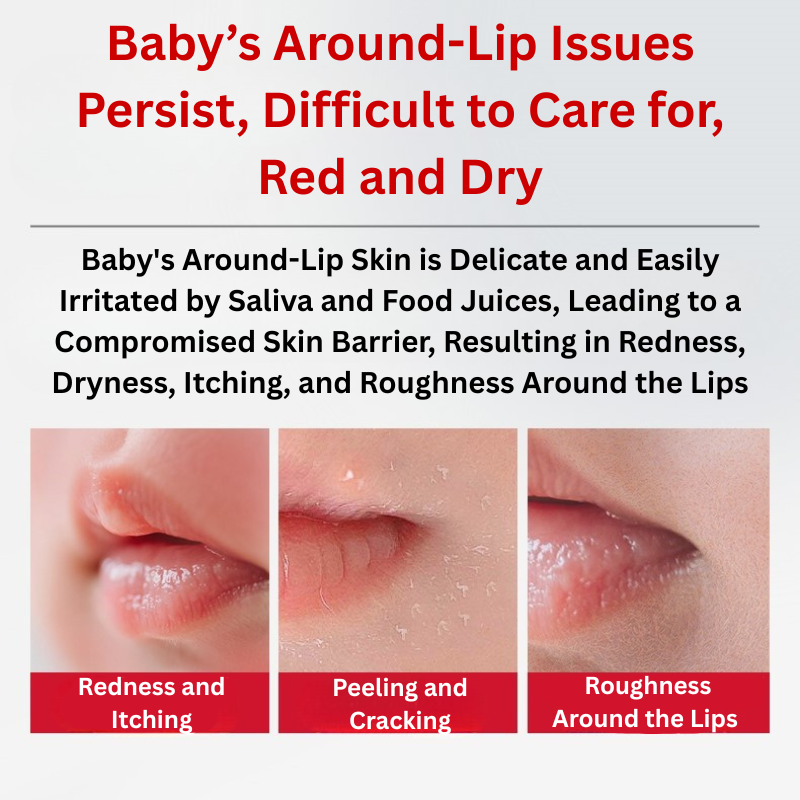 WINONA Baby Soothing Around-Lip Cream 15g 薇诺娜宝贝舒润唇周膏