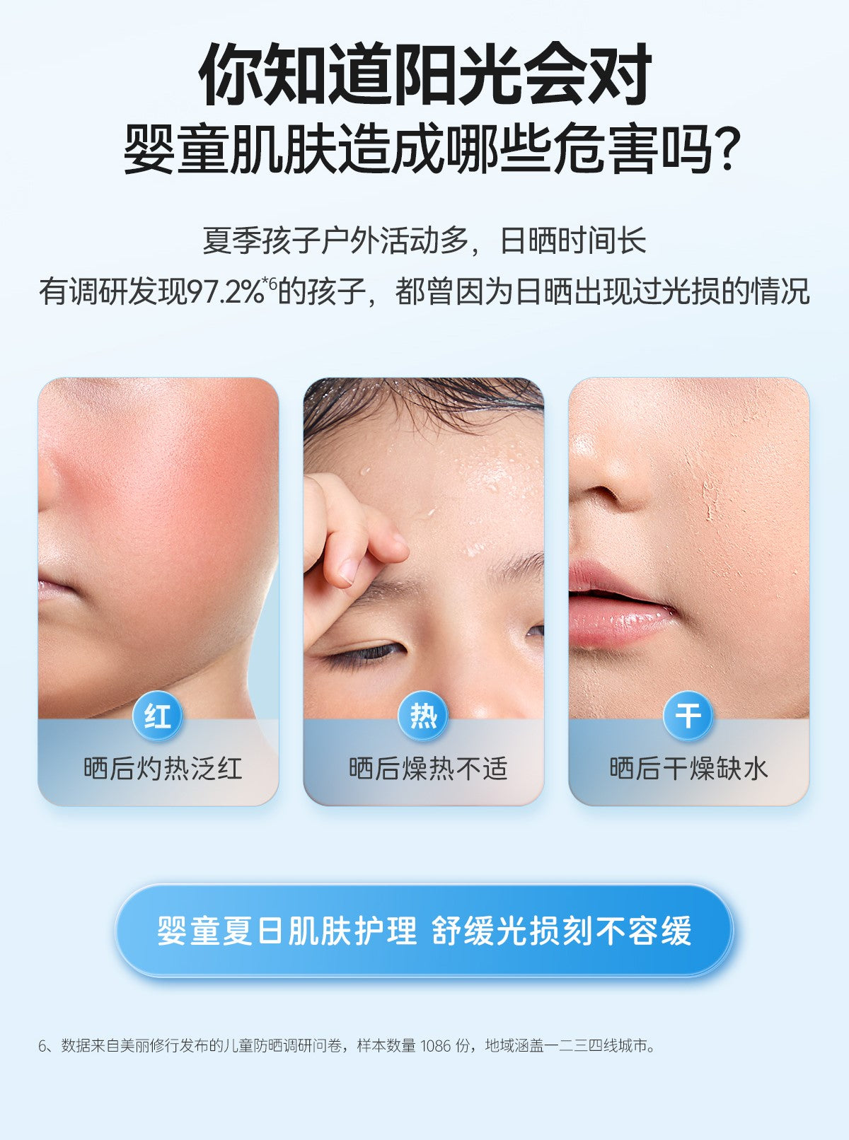 YUMEIJING Baby Edelweiss Soothing Ice Cream 50g 郁美净婴童雪绒花舒缓冰凝霜