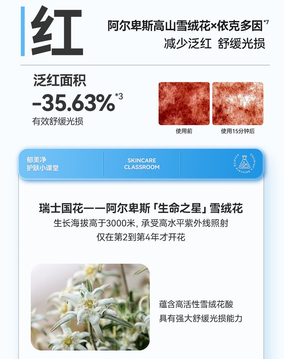 YUMEIJING Baby Edelweiss Soothing Ice Cream 50g 郁美净婴童雪绒花舒缓冰凝霜