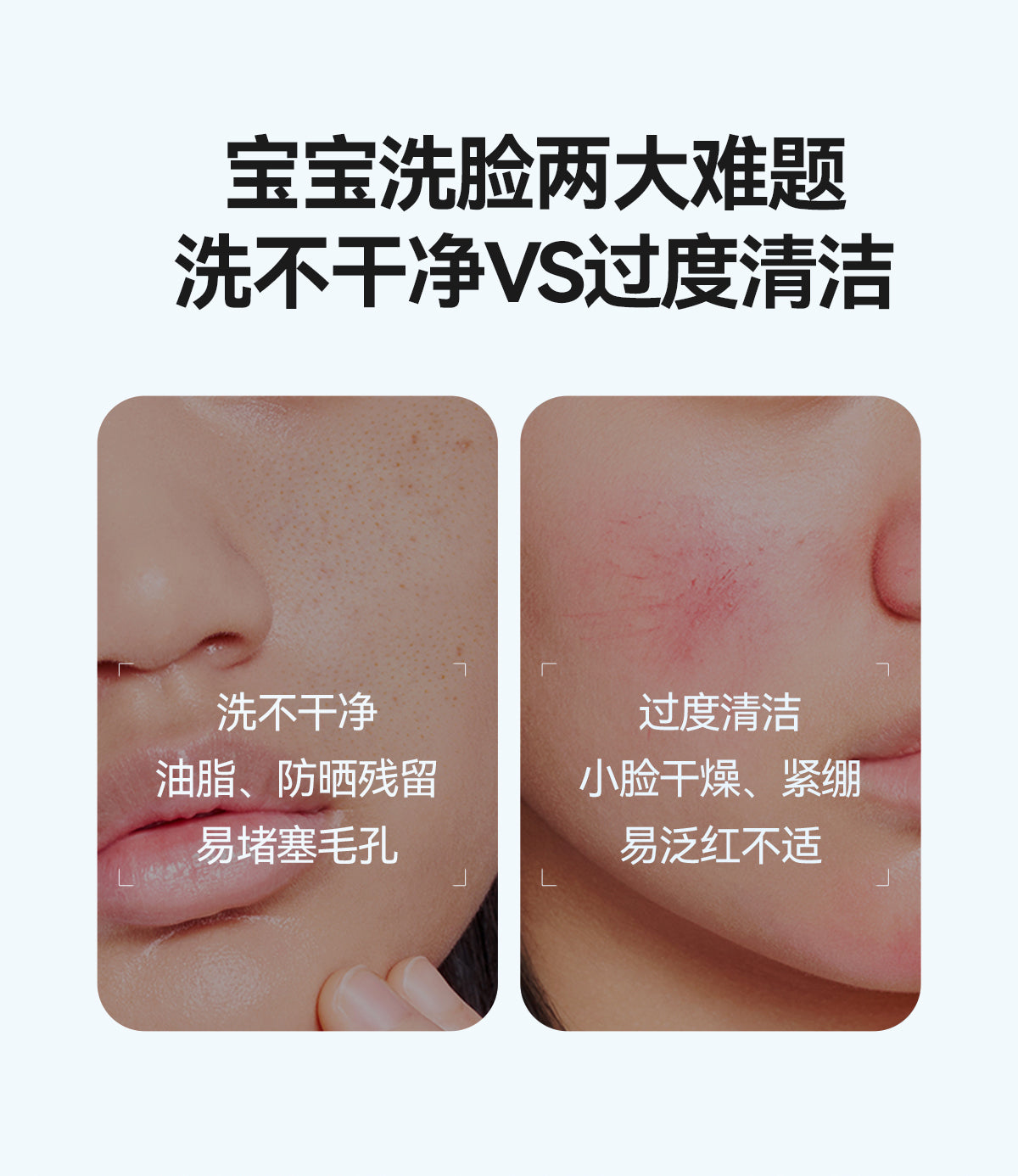 YUMEIJING Kid Edelweiss Moisturizing And Gentle Cleanser 100g 郁美净儿童雪绒花保湿温和洁面乳