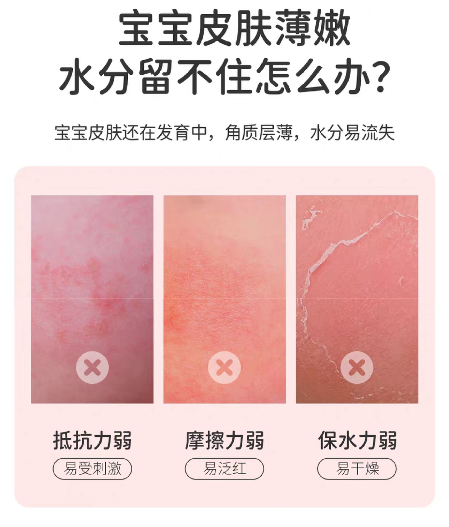 YUMEIJING Gold Medal Kids Cream 40g 郁美净金牌儿童霜