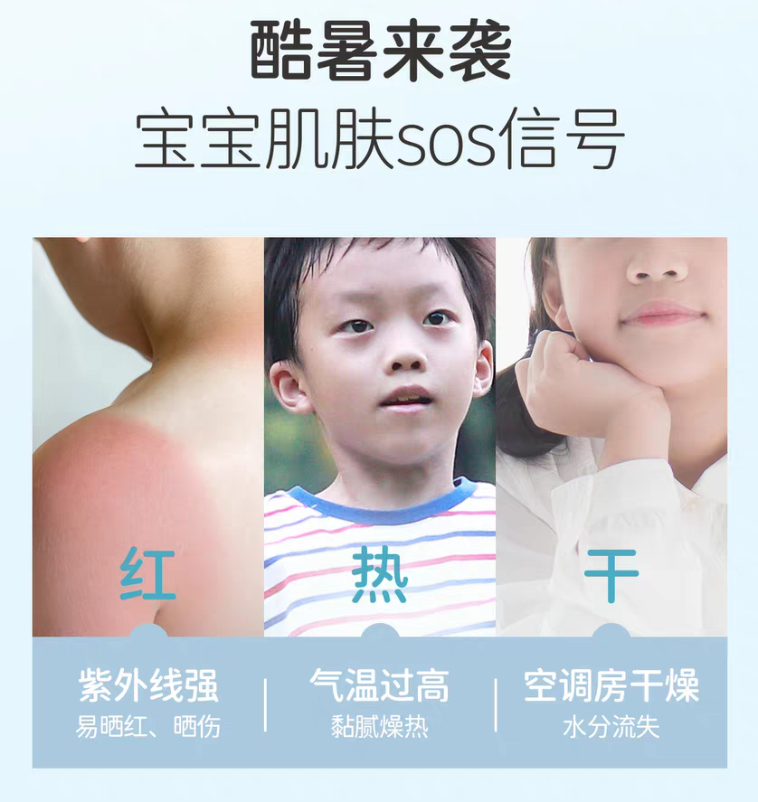 YUMEIJING Kids Soothing Ice Cream Gel Cream 50g 郁美净儿童舒缓冰沙霜